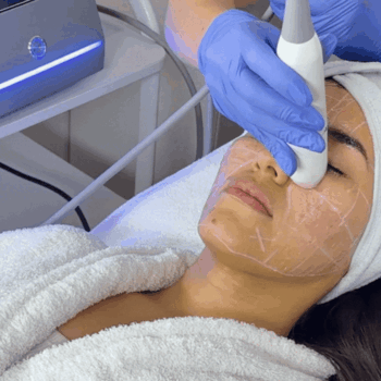 Tratamiento facial aparatología